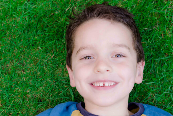 Diastema, ¿Moda Atractiva?
