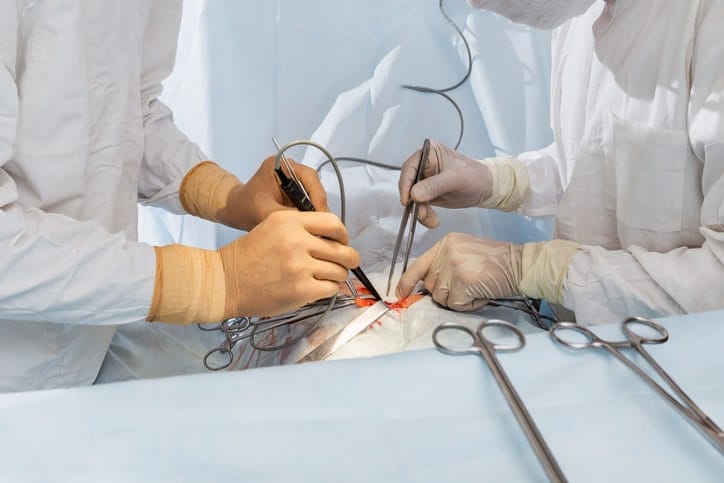 Transplante de Corazón