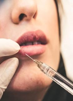 Bioplastia facial para rejuvenecer el rostro