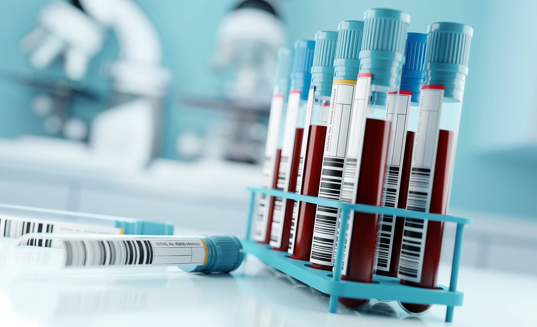 Analítica hormonal: ¿Cuándo realizarla?
